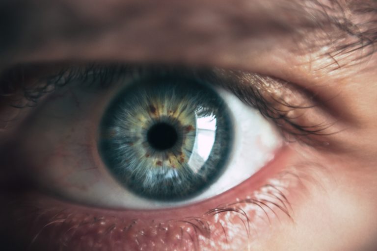 oeil iridologie