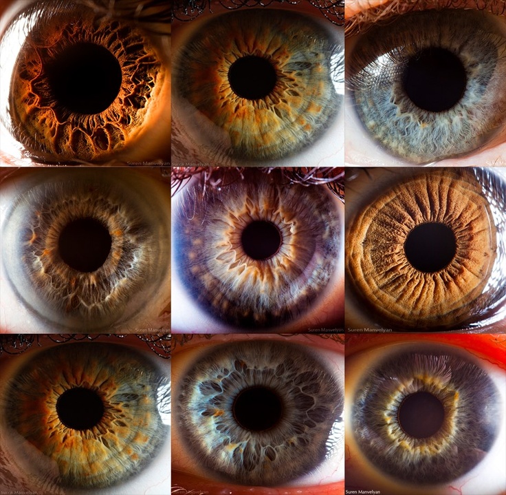 oeil irigologie
